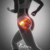 Hip Replacement Surgery in Mexico: Affordable, Reliable Surgery for California Tourists